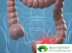 ��ֱ��������ֱ������᳦���������͵İ�֢