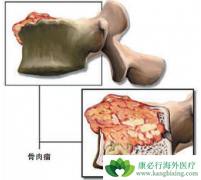 ����ҩ���ȿɽ�����������Զ��ת�Ʒ��ս���һ��