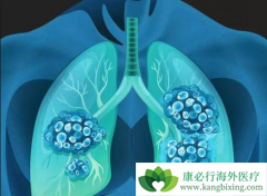 ��Ч����ת���Էΰ��ķ���������Щ��