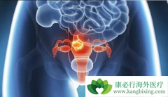 �ѳ�����Ҫ�������ѳ������ƶ೤ʱ����Կ�����Ч��