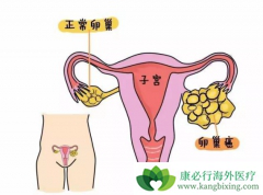 �ѳ������ڶ��ѳ���������ʲô������