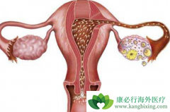 �ѳ��������ѳ����������׺�������������ʲô��