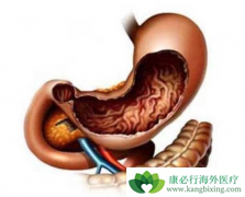 θ���������������󸴷��ļ��ʸ߲��ߣ�