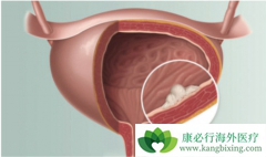 �˽���װ�������֢״�ɰ����������շ��ֲ���