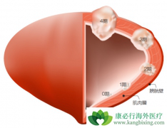 ���������ǰ��װ�����֢״��