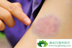 ����������°�Ѫ��ǰ��ʱӦ�Ͻ���ҽ��