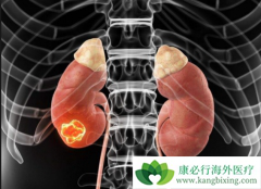 ���ѡ������������һ�����ƣ��ð������ƻ����������ƣ�