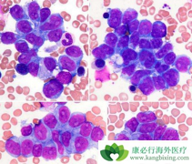 �����Զ෢�Թ����������еĸ����ã�