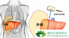 ����ֲ����������Ҫע��Щʲô���⣿