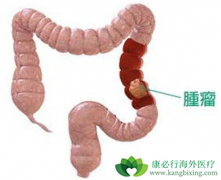 �󳦰��ķ�����������Щ���ؾ���ֱ�ӹ�ϵ��