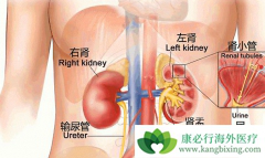 ����ת�Ƶ���Ҫ֢״���ֶ�����Щ��