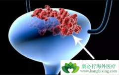 ��ķ�������ư��װ����ڵ��ٴ�Ч�����ڻ���