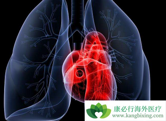 肺动脉高压治疗 肺动脉高压治疗