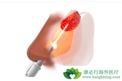 �յ����ƿ�������߱��ʰ����ƵĴ����