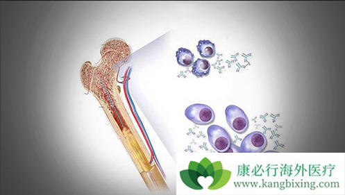多发性骨髓瘤 多发性骨髓瘤
