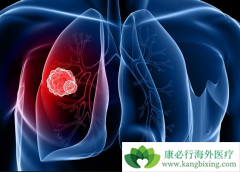 �ΰ���ת�ƻ����ܴ����������л�����