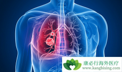 �����Ч����ת���Էΰ����µĺ�������֢״��