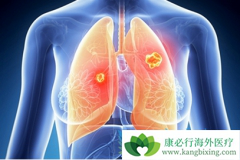 ת���Էΰ�ͨ������Щ֢״���֣�