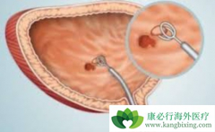 �˽���װ�������֢״������Щ