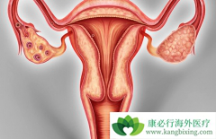 �¾�����Ҳ�Ǹ��ư�֢�ѳ���������֢״֮һ