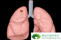 �ΰ����ڳ�ʲô�ã���AZD9291����