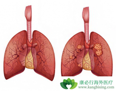 ��������/������������Щ�ΰ�ͻ�仼����Ч��