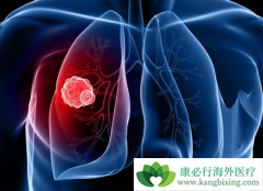 Сϸ���ΰ���ת�ƺ���ô���ƺã�