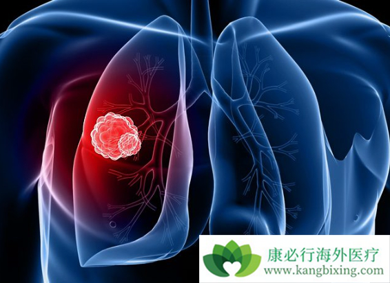 小细胞肺癌 小细胞肺癌