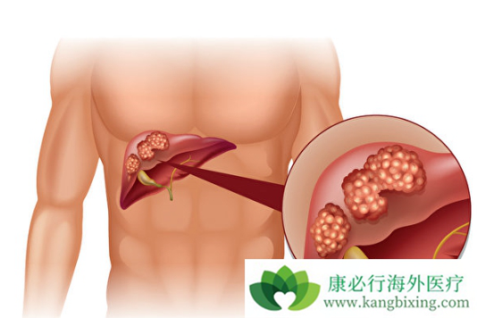 分子靶向治疗 分子靶向治疗