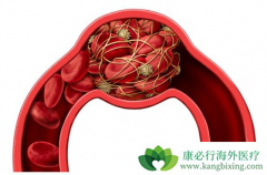 �쳣��Ѫ�ǰ�Ѫ��������֢״֮һ