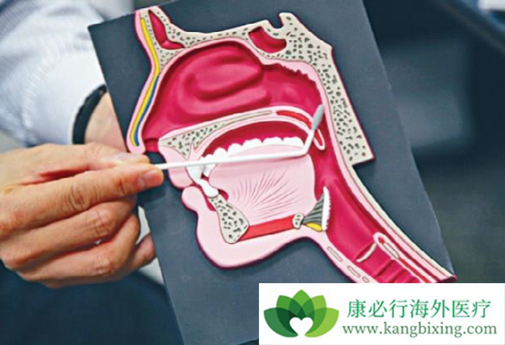 鼻咽癌治疗 鼻咽癌治疗