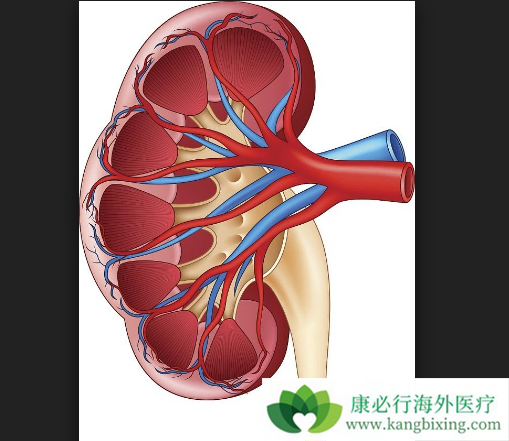 肾癌转移 肾癌转移