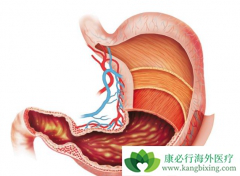 �����鵥��������θ��������Ч������