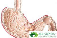 ����θ���ܻ��ã�����Щ��������ҩ����ã�