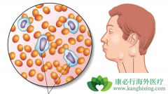 �ǻ�����ܰ������Ʒ�������Щ����Ч�ֱ���Σ�