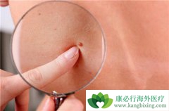 ��������������Щ���ࣿ��ͬ���͵�֢״�кβ�ͬ��