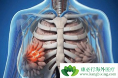 ��Щ���ػ�Ӱ�����ٰ������ļ��ʣ�