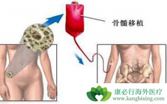 ��Ѫ��������ֲ����������������ô�죿