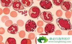 ��Ѫ���������������Щ������ֱ�ӹ�ϵ��