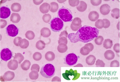 ��Ѫ����Ⱦ�𣿰�Ѫ��������֢״����Щ��