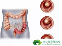 ��ֱ����ͨ��������Щ����֢״��