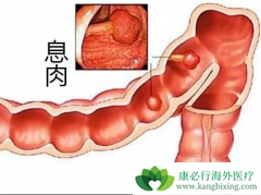 ��ֱ�������շ����ض�����Щ��