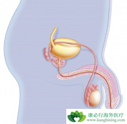 ǰ���ٰ�����ʲôʱ��ʹ�ö�������Ч���ã�