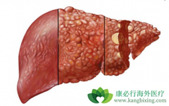 �ɱ��ν�չ�����ĸΰ����κ���