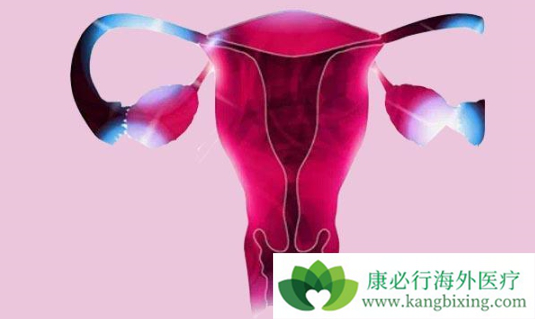 妇科癌症 妇科癌症