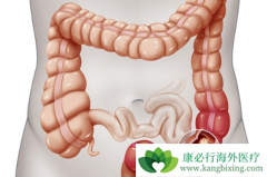 ���ڽ�ֱ�������Ӱ������������ٵ�����