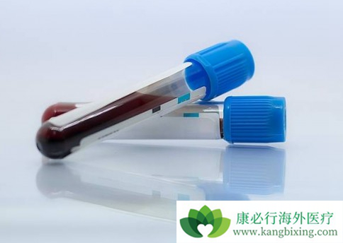 丙肝病毒 丙肝病毒