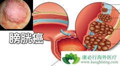 Ѫ���ǰ��װ�����֢״֮һ��