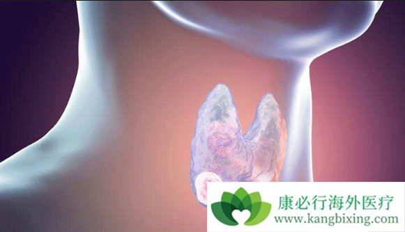 甲状腺肿瘤症状 甲状腺肿瘤症状