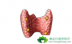 ��״�������������ճ���ʳ��Ӧע��ʲô��